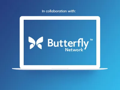 Intelligent Supply Chain Planning with Butterfly Network
